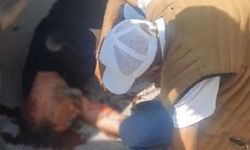KAFASINA TABANCA KABZASIYLA VURULAN ŞAHIS AĞIR YARALANDI