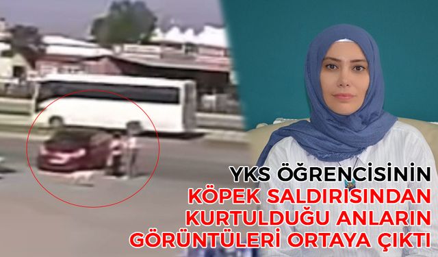 YKS Öğrencisinin Köpek Saldırısından Kurtulduğu Anların Görüntüleri Ortaya Çıktı!